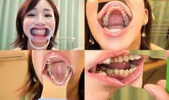 Iroha - Watching Inside mouth of Japanese attractive mature lady - wmv