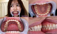 Mion Hazuki - Watching Inside mouth of Japanese cute girl bite-273-1 - 1080p ---