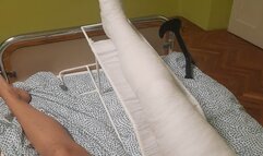 Betti long leg walking cast making in the hospital