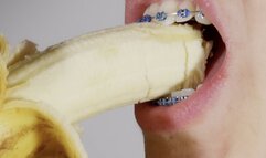 braces close-up and eating banana
