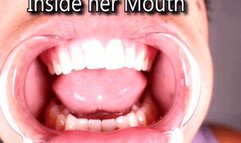 Inside Jen's Mouth (iPhone)