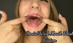 Dental Work Mouth Fetish Custom