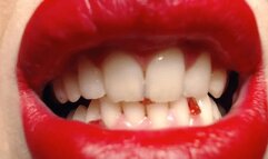 Stasha's sharp teeth