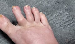 Showing my rough toes with callouses