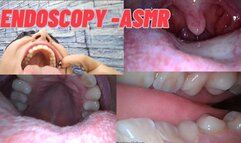 Vore endoscopy -ASMR