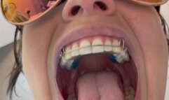 Giantess With Braces Vore POV