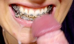 Braces HERBST German dirty-talk, HUGE cumshot