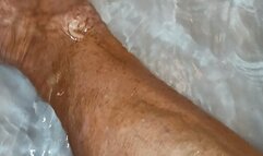 In the tub and muscular calves after cast was removed