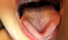 ORAL EXAMINATION {LIGHTING THE TONGUE | Laura