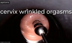 cervix wrinkled orgasms - captioned