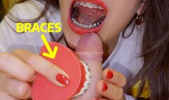 Braces HERBST cock-biting with braces-model, CUM on teeth