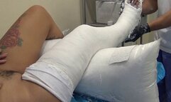 Naomi Hip accident part two