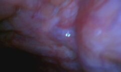 Sloanes Throat and Stomach (REVERSE ENDOSCOPE)