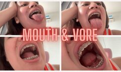 Mouth and vore fetish whit braces