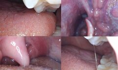 Macro endoscope mouth tour