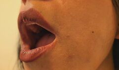 ORAL EXAMINATION: OPEN LIPS OF THE MOUTH | Laura