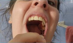 Exploring My Cavities in Extreme Close-Up - Deep Mouth View