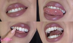 Aligner progress & updates #2 ~ Sweet Maria