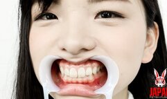 [Teeth Observation] Natural Teeth But Potential Cavities Found!! Beauty Cries When Her Teeth Are Tapped - Suzu Shiratori