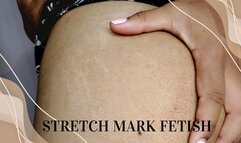 Stretch Marks Fetish