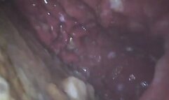 Sloane: Breakfast Remains (STOMACH ENDOSCOPE FOOTAGE)