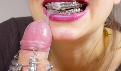 BRACES dentist roleplay, DIRTY TALK, HUGE cumshot