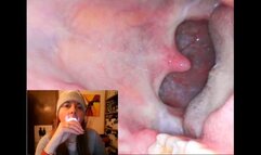 Endoscopy catarrh saliva and mouth exploration 4K