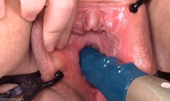 stronic in my peehole for the first time