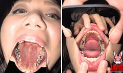 Teeth Obsession Unleashed: The Sensational Video Starring Reina Kitamura