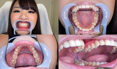 Kurumi - Watching Inside mouth of Japanese pretty girl BITE-45-1 - wmv