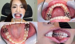 Miyuki - Watching Inside mouth of Japanese cute lady BITE-46-1 - wmv 1080p