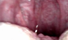 Endoscope in my throat 1