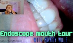 Endoscope mouth tour - Mandy Wolf - HD 720 MP4