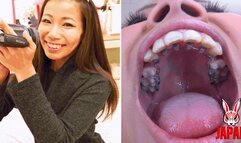 Orthodontic Teeth Fetish : Izumi Asato's Dental Fantasy