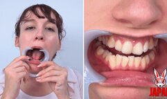 Teeth Fetish : Dental Examination with Clara Luroa