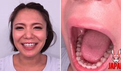 Teeth Examination: Beauty Unveiled