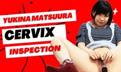 The Cervix examination of Yukina Matsuura