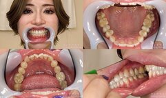 ERINA - Watching Inside mouth of Japanese cute girl bite-255-1 - 1080p