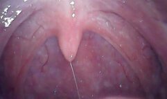 YAWNING MAGICIAN HARBOURED HIS TINY BODY INSIDE MY PUSSY - UVULA (WITH SOUND)