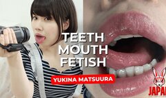 Mouth Fantasy: Dental Selfies with Sensual Yukina MATSUURA
