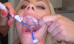 Inside My Mouth - Silvia and Brittany have a dental checkup (MOBILE)