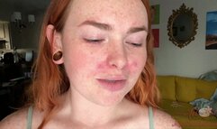 Freckled Bare Face Worship (mp4)