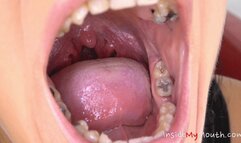 Inside My Mouth - Lexi Dona - mouth examination and exploration (FullHD)