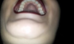 Show my mouth and teeth 6