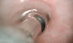 juicy cervix sounding (720 mp4)