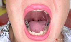 Inside My Mouth - Vanessa's mouth examination and exploration (MOBILE)