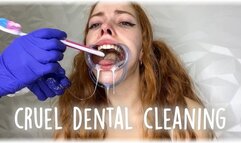 CRUEL DENTAL CLEANING 1080 wmv