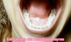 Close Up Mouth and Teeth -Kodak Macro Lens- 117_2539