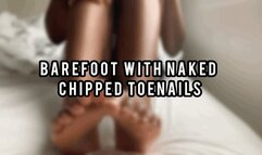 Barefoot Chipped Toenails