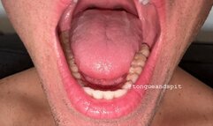 Andrew Mouth and Lower Teeth Part16 Video1 - MP4